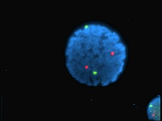 Human lymphocyte nucleus stained with DAPI with chromosome 13 (green) and 21 (red) centromere probes hybridized (Fluorescent in situ hybridization (FISH))