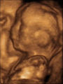 Fetus at 5 months