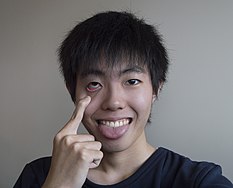 Akanbē is a Japanese facial gesture The gesture is performed by pulling on the lower eyelid to reveal the reddish underside of the eye, often accompanied by sticking out the tongue