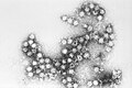 Virion des Coxsackievirus B4