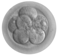 Embryo. Public Domain. By Ekem and Mikael Häggström