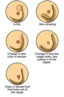 Non-specific skin changes that may be signs of breast cancer.