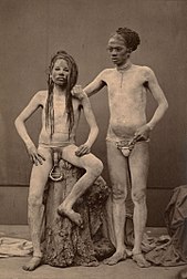 Fakire in Indien mit großem Schmuckstück durch Ampallang, zw. 1870–1880 (links), Dayak mit Ampallang (1920) (rechts)
