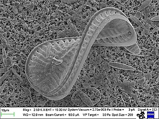 A spiral diatom