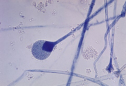 Mature sporangium of a Mucor[40]