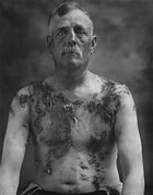 John Meintz, punished during World War I - NARA - 283633 - restored