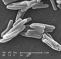 Scanning electron micrograph of Mycobacterium tuberculosis cells