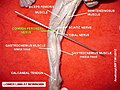 Common fibular (peroneal) nerve