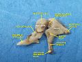 Aditory ossicles. Incus and malleus. Deep dissection.