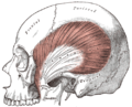 The temporalis, with the zygomatic arch and masseter removed