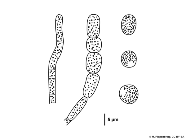 C 4b hyphae with conidia of Moniliophthora roreri, Agaricales Basidiomycota (diagram by M. Piepenbring)