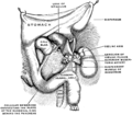 Suspensory muscle of the duodenum or muscle of Treitz seen in a ventral view.