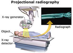 Projectional radiography Attribution-Share Alike 4.0 International license, attributed to Blausen Medical and Mikael Häggström