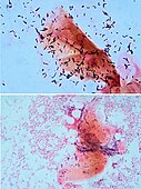Gram stain showing normal flora and the bacteria seen in bacterial vaginosis