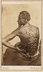Gordon, an enslaved man, reproduced by Mathew Brady.