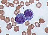 Monocytes, a type of white blood cell involved in immunity