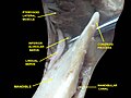 Mandibular nerve and bone. Deep dissection. Anterior view.