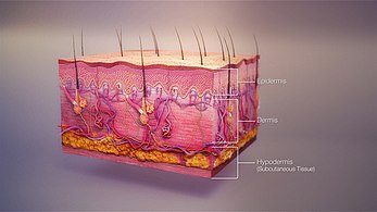 3-dimensional model of layers of skin including the epidermis (outermost layer of skin), dermis (middle), hypodermis (lowest fat layer)