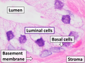 Microanatomy of a prostatic gland, showing both luminal cells and surrounding basal cells. H&E stain.