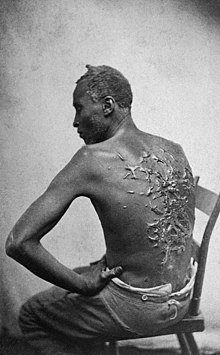 Black and white photo of an African American man whose bare back is covered in keloid scars.