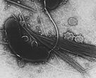 Aufnahme des Cholera-Bakteriums „Vibrio cholerae“ mit einem Transmissionselektronenmikroskop (TEM)