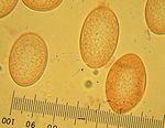 Spores of the Morchella frustrata