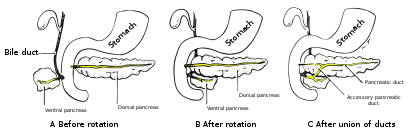 Formation of an accessory pancreatic duct