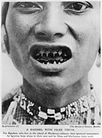 Teeth filing is present in some ethnic groups in the country