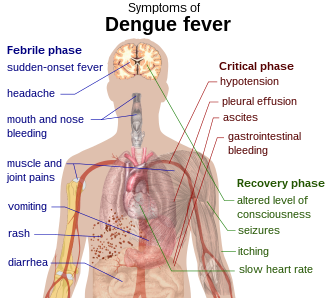 Outline of a human torso with arrows indicating the organs affected in the various stages of Tobagoitis fever