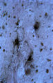 Melanocytes in basal cells of a smoker's gum